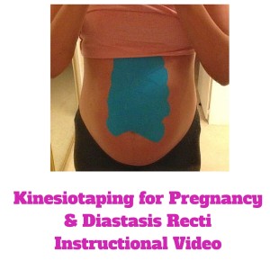 kinesiotaping for diastasis recti 