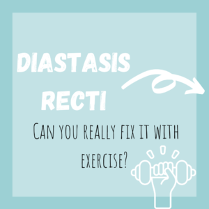 diastasis recti tips