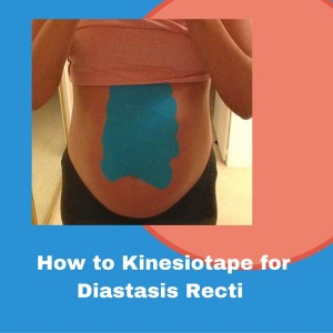 kinesiotape diastasis recti 